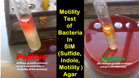 soft agar motility test|motility tests for bacteria.